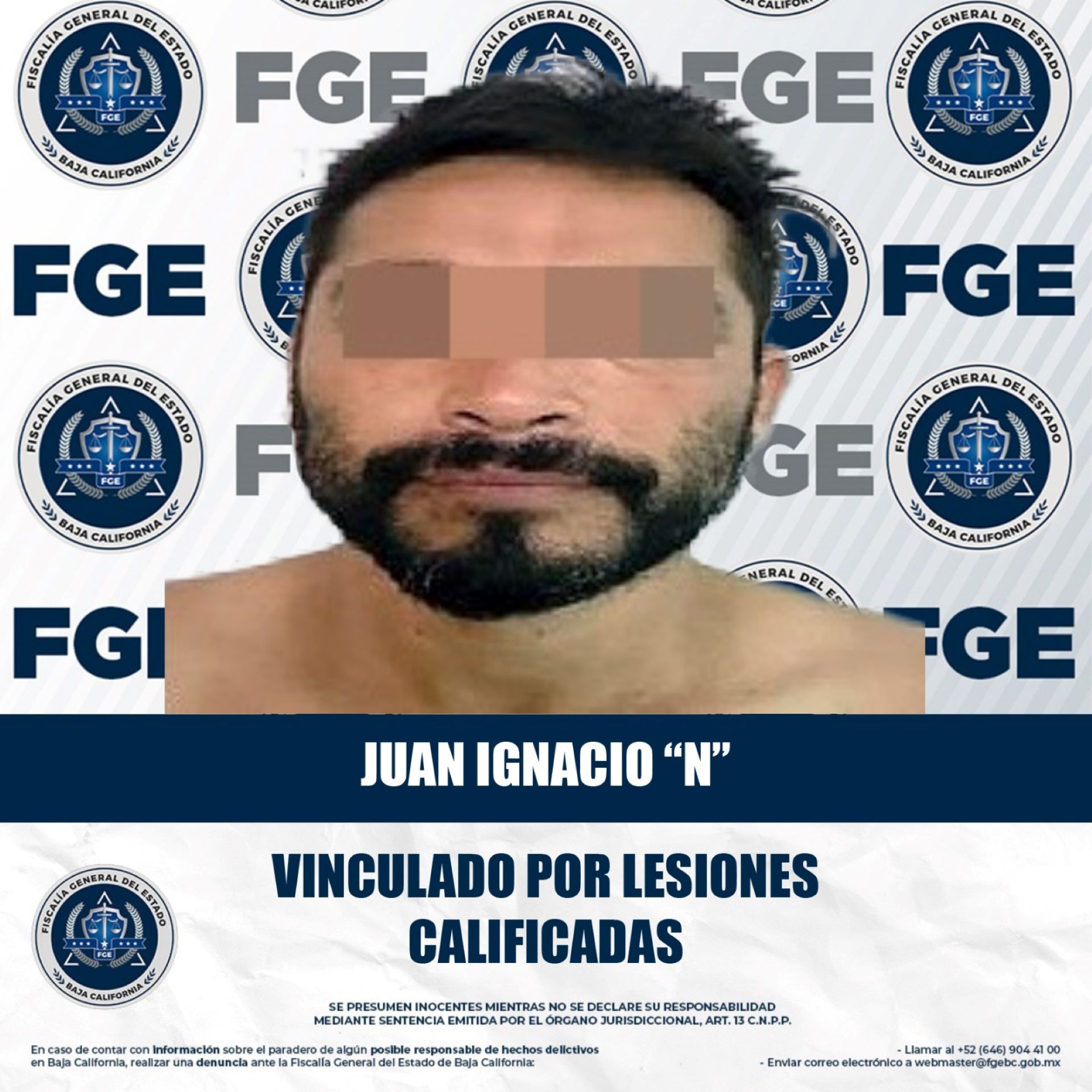 Imputado por el delito de lesiones calificadas queda en prisión preventiva