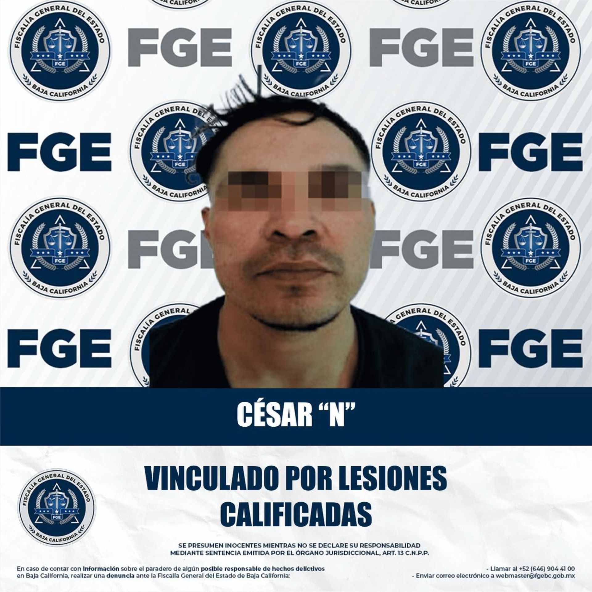 Fijan prisión preventiva a imputado por el delito de lesiones calificadas